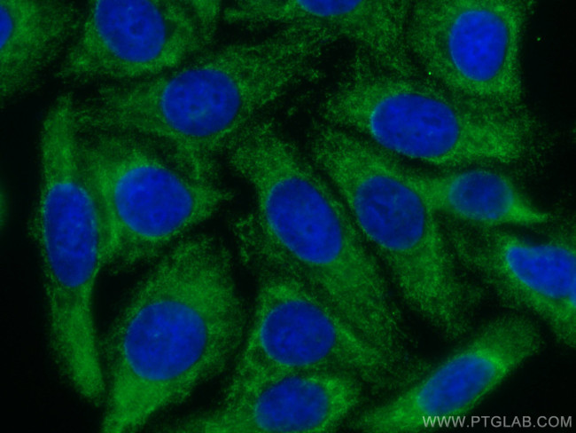 USP13 Antibody in Immunocytochemistry (ICC/IF)