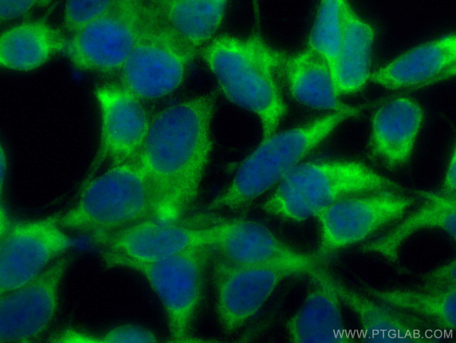 HSP70 Antibody in Immunocytochemistry (ICC/IF)