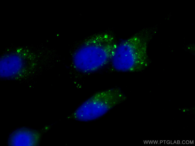 P62/SQSTM1 Antibody in Immunocytochemistry (ICC/IF)