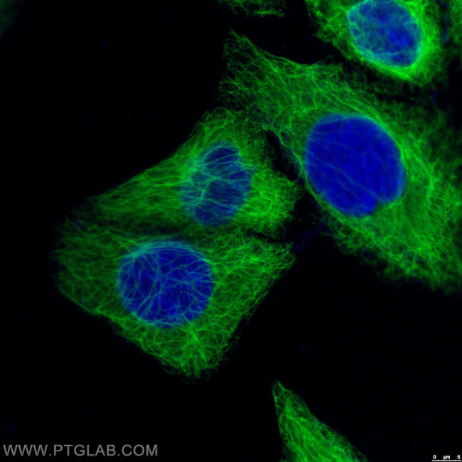 Cytokeratin 18 Antibody in Immunocytochemistry (ICC/IF)