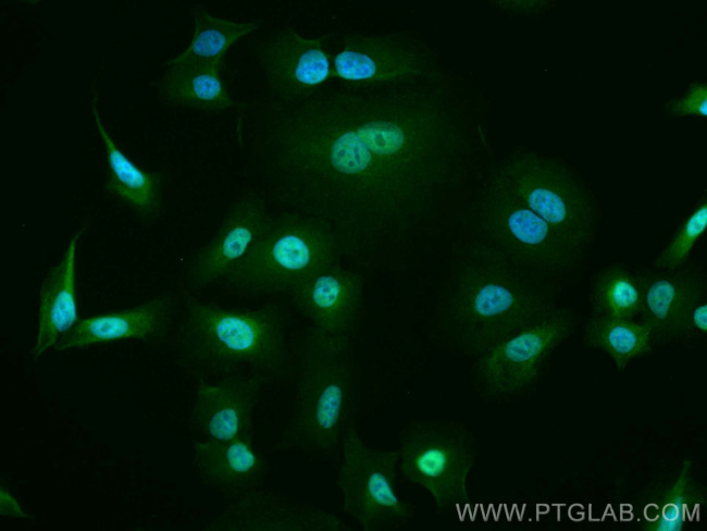 USP5 Antibody in Immunocytochemistry (ICC/IF)