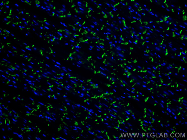 N-cadherin Antibody in Immunohistochemistry (PFA fixed) (IHC (PFA))