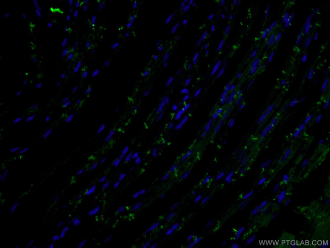 N-cadherin Antibody in Immunohistochemistry (PFA fixed) (IHC (PFA))