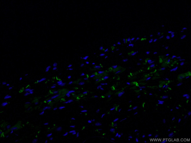 N-cadherin Antibody in Immunohistochemistry (PFA fixed) (IHC (PFA))