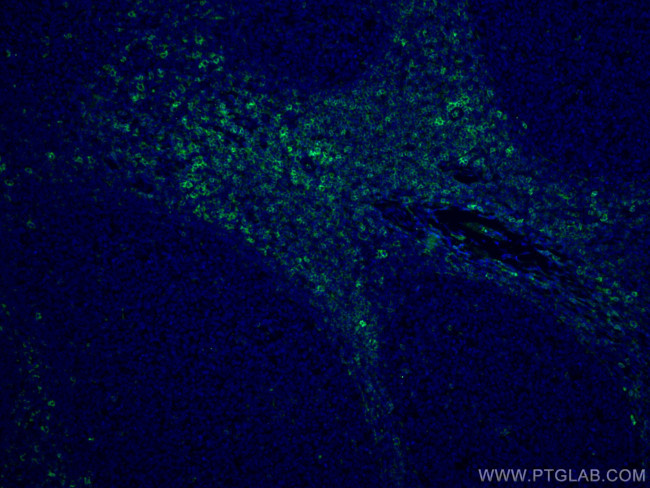 CD43 Antibody in Immunohistochemistry (PFA fixed) (IHC (PFA))