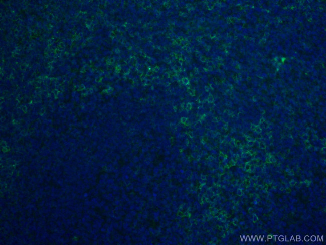 CD43 Antibody in Immunohistochemistry (PFA fixed) (IHC (PFA))