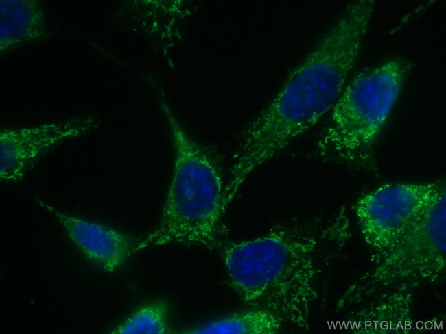 Adiponectin Antibody in Immunocytochemistry (ICC/IF)