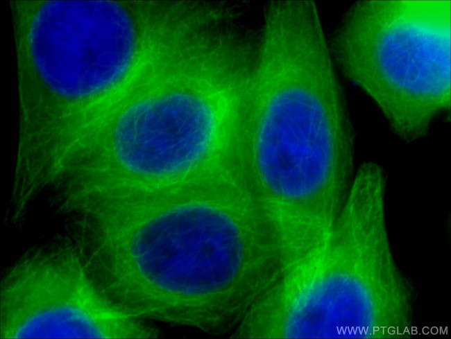 beta Tubulin Antibody in Immunocytochemistry (ICC/IF)