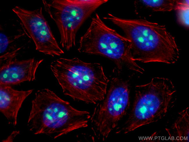 IMP3 Antibody in Immunocytochemistry (ICC/IF)