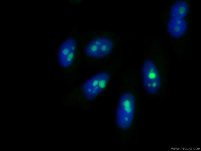 IMP3 Antibody in Immunocytochemistry (ICC/IF)