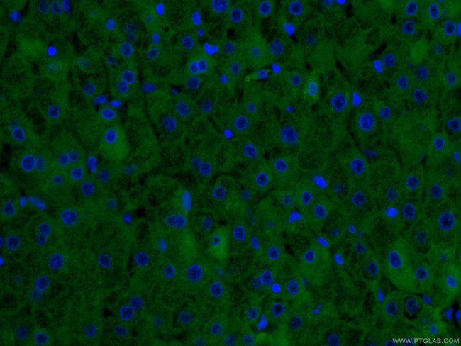 CRP Antibody in Immunohistochemistry (PFA fixed) (IHC (PFA))