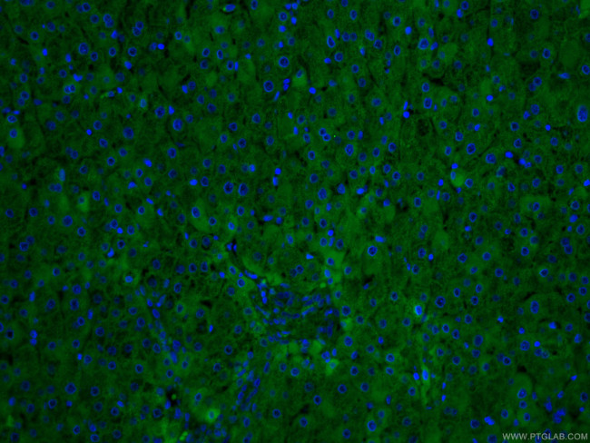 CRP Antibody in Immunohistochemistry (PFA fixed) (IHC (PFA))