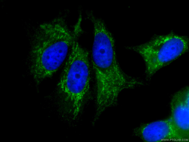 FRS2 Antibody in Immunocytochemistry (ICC/IF)