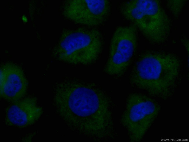 SRPX2 Antibody in Immunocytochemistry (ICC/IF)