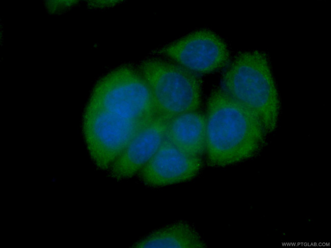 CAPG Antibody in Immunocytochemistry (ICC/IF)