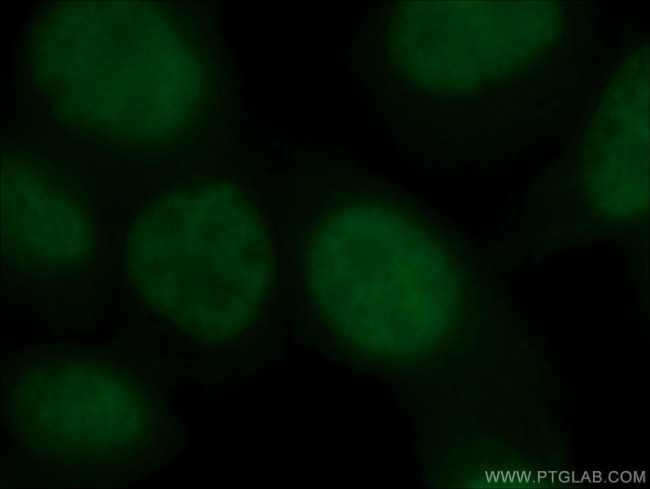 YY1 Antibody in Immunocytochemistry (ICC/IF)