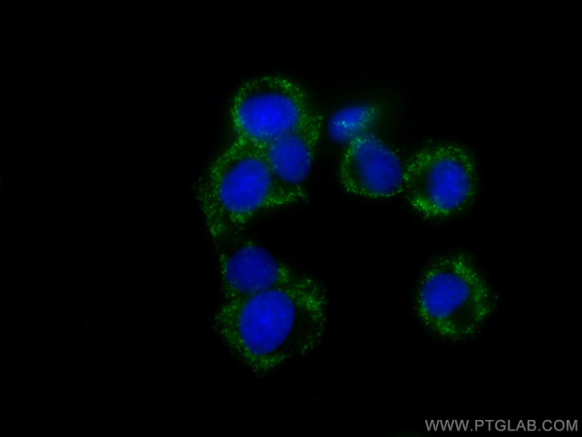 BDNF Antibody in Immunocytochemistry (ICC/IF)