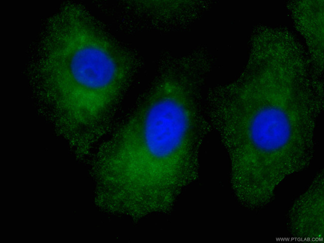 RSPO3 Antibody in Immunocytochemistry (ICC/IF)