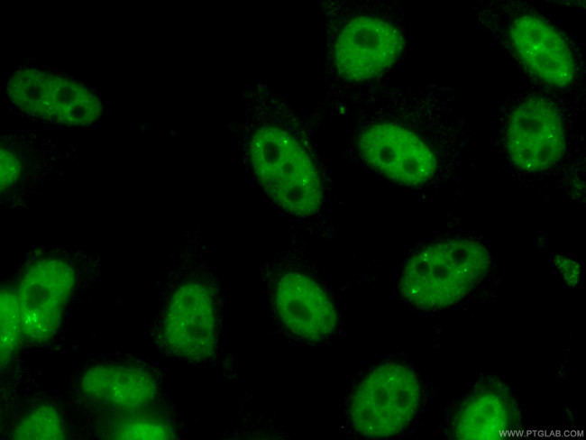 NUDT21 Antibody in Immunocytochemistry (ICC/IF)