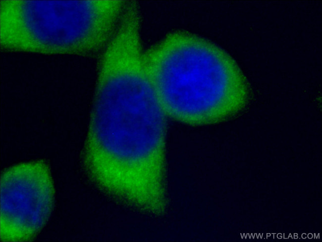 G6PD Antibody in Immunocytochemistry (ICC/IF)