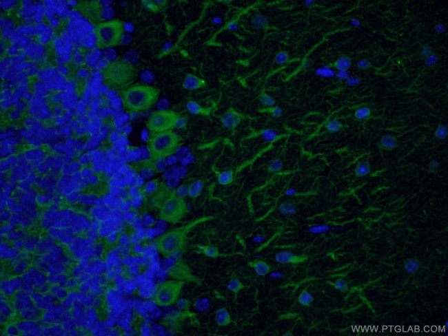 TUBB3-specific Antibody in Immunohistochemistry (PFA fixed) (IHC (PFA))