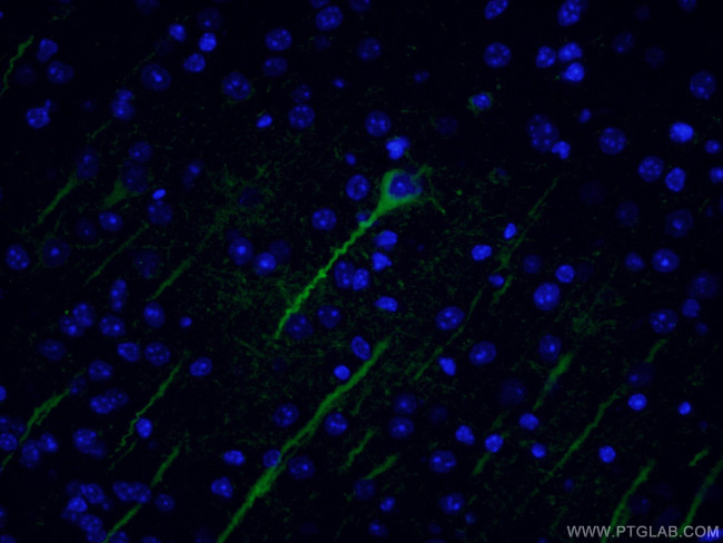 TUBB3-specific Antibody in Immunohistochemistry (PFA fixed) (IHC (PFA))