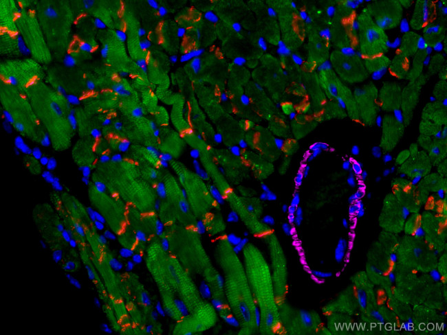 Cardiac Troponin I Antibody in Immunohistochemistry (PFA fixed) (IHC (PFA))