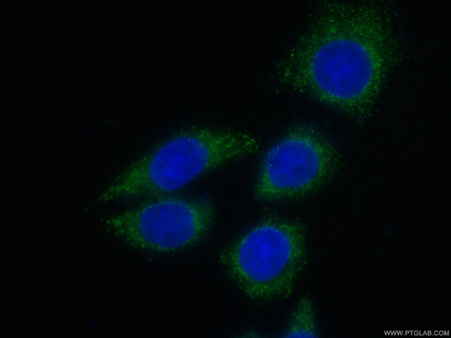 Cardiac Troponin I Antibody in Immunocytochemistry (ICC/IF)