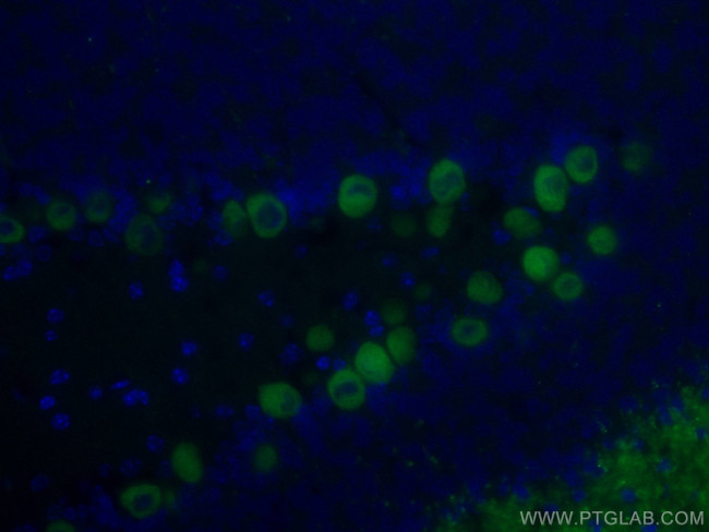 Calbindin-D28k Antibody in Immunohistochemistry (PFA fixed) (IHC (PFA))