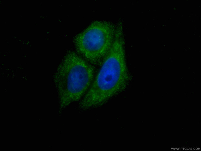 SIRT2 Antibody in Immunocytochemistry (ICC/IF)