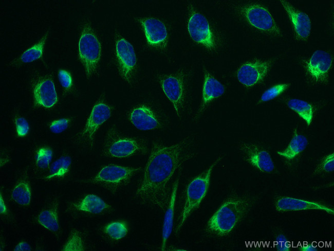 LAP3 Antibody in Immunocytochemistry (ICC/IF)