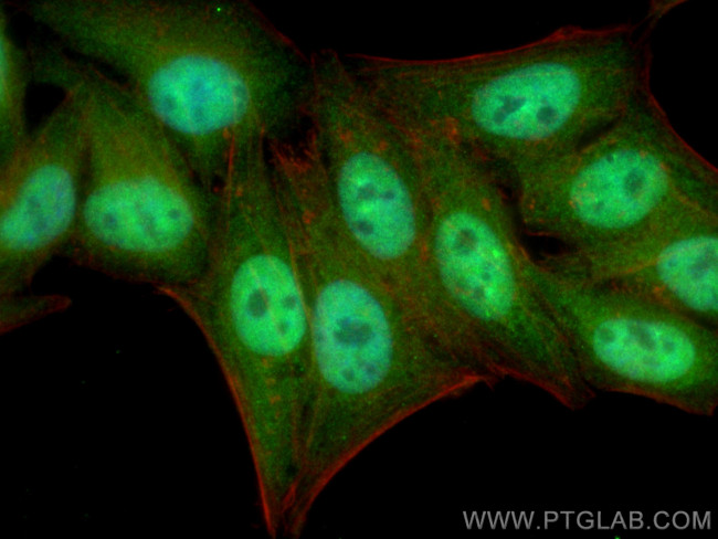 STAT5B Antibody in Immunocytochemistry (ICC/IF)