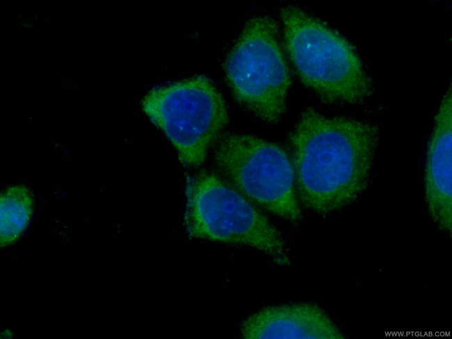 SLP76 Antibody in Immunocytochemistry (ICC/IF)