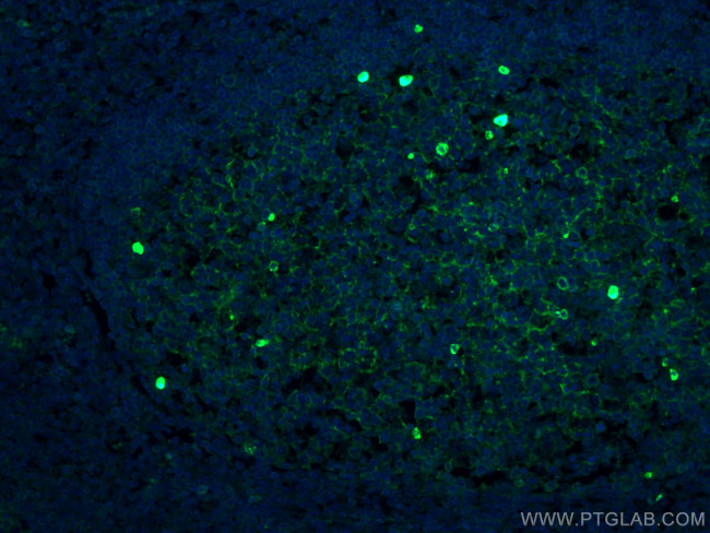 IGHM Antibody in Immunohistochemistry (PFA fixed) (IHC (PFA))