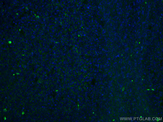 IGHM Antibody in Immunohistochemistry (PFA fixed) (IHC (PFA))