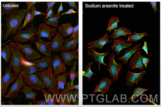 G3BP1 Antibody in Immunocytochemistry (ICC/IF)