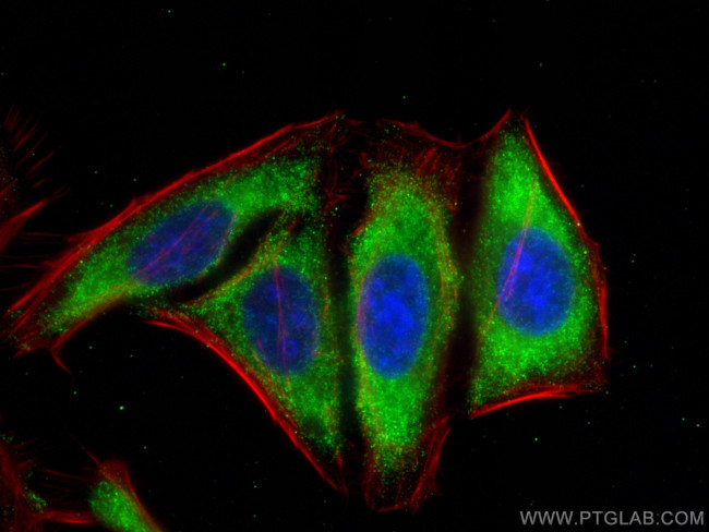 CLTC Antibody in Immunocytochemistry (ICC/IF)