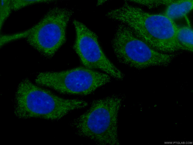 CLTC Antibody in Immunocytochemistry (ICC/IF)