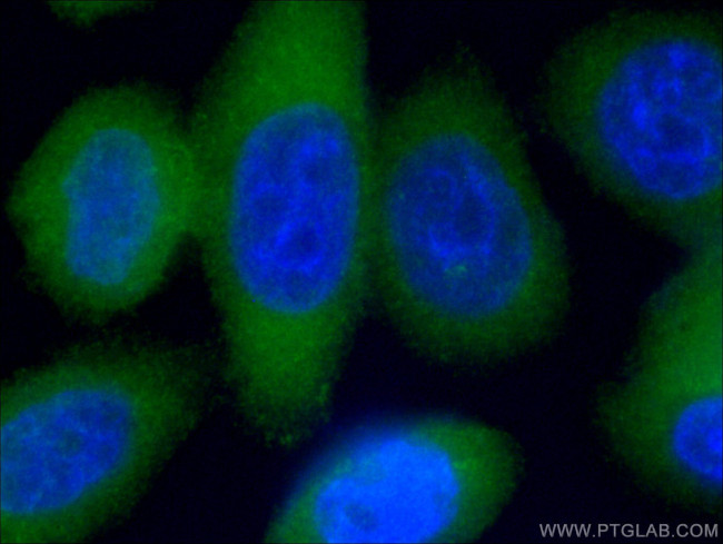 PKC iota Antibody in Immunocytochemistry (ICC/IF)