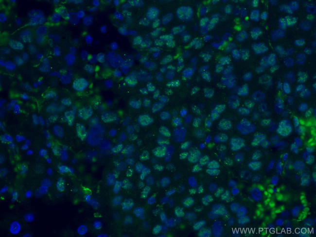 WWTR1 Antibody in Immunohistochemistry (PFA fixed) (IHC (PFA))