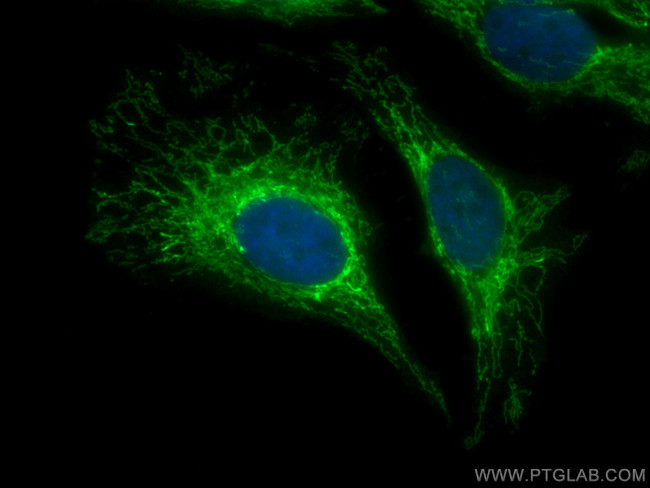 PYCR1 Antibody in Immunocytochemistry (ICC/IF)