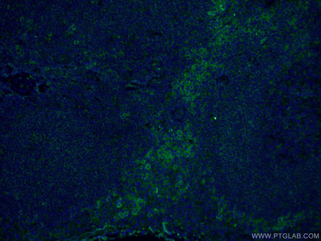 FCGR2A / CD32a Antibody in Immunohistochemistry (PFA fixed) (IHC (PFA))