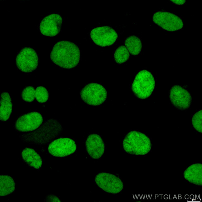 XRCC5 Antibody in Immunocytochemistry (ICC/IF)