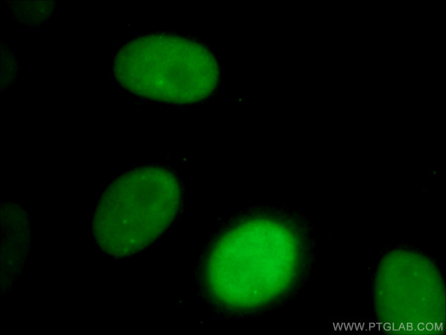 SMARCA4 Antibody in Immunocytochemistry (ICC/IF)