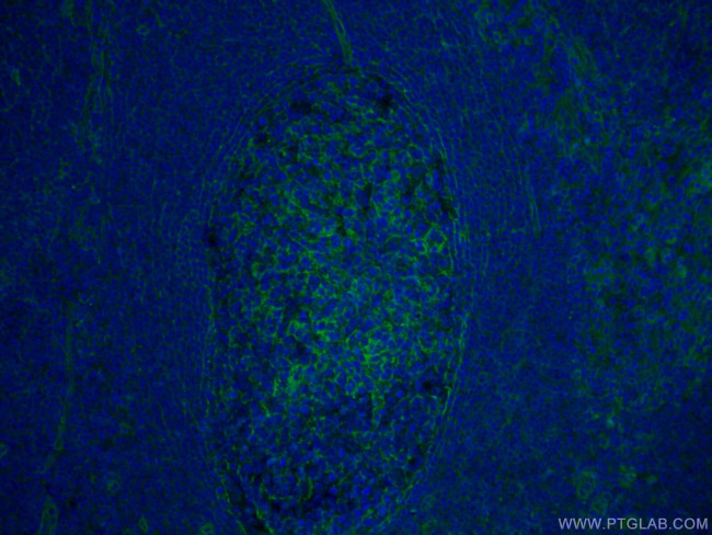 CD151 Antibody in Immunohistochemistry (PFA fixed) (IHC (PFA))