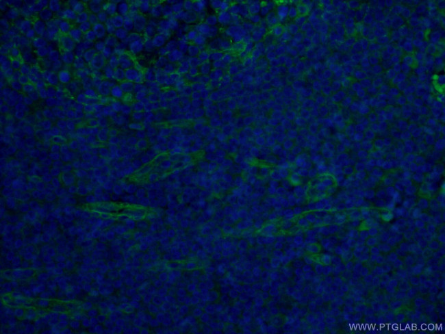 CD151 Antibody in Immunohistochemistry (PFA fixed) (IHC (PFA))