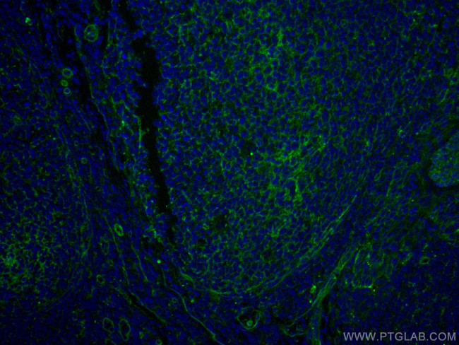 CD151 Antibody in Immunohistochemistry (PFA fixed) (IHC (PFA))