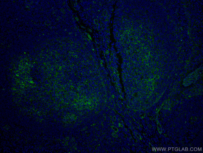 CD151 Antibody in Immunohistochemistry (PFA fixed) (IHC (PFA))