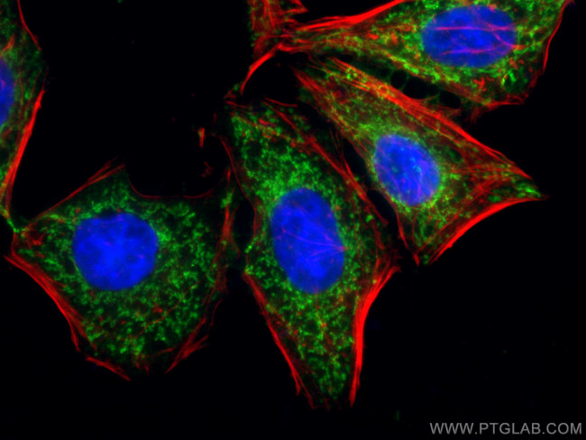 SDHA Antibody in Immunocytochemistry (ICC/IF)