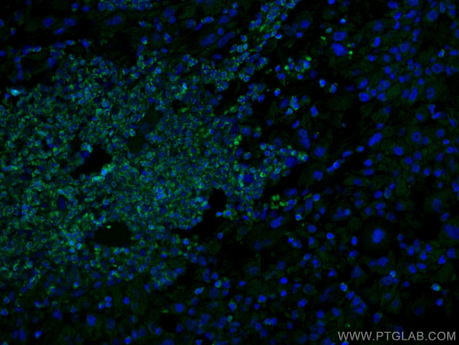 MLKL Antibody in Immunohistochemistry (PFA fixed) (IHC (PFA))